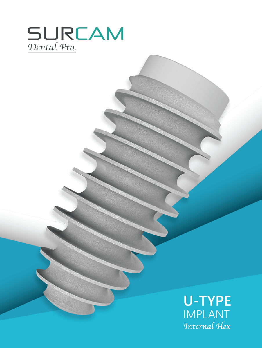 U-type