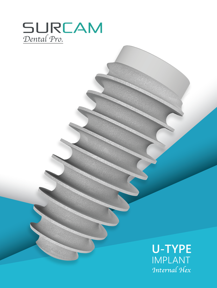U-type